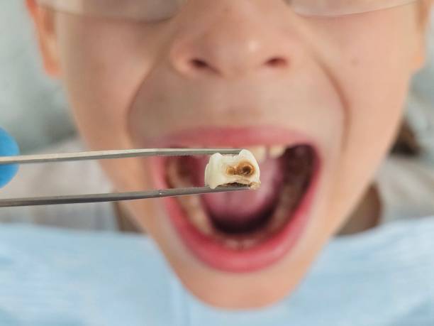 Best Urgent Care for Lost Fillings or Crowns in Hot Springs, AR